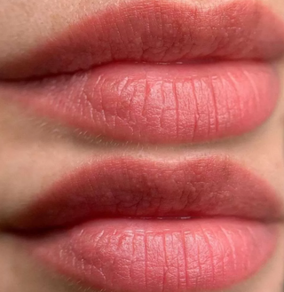 LIPS - RASPBERRY TARTLET